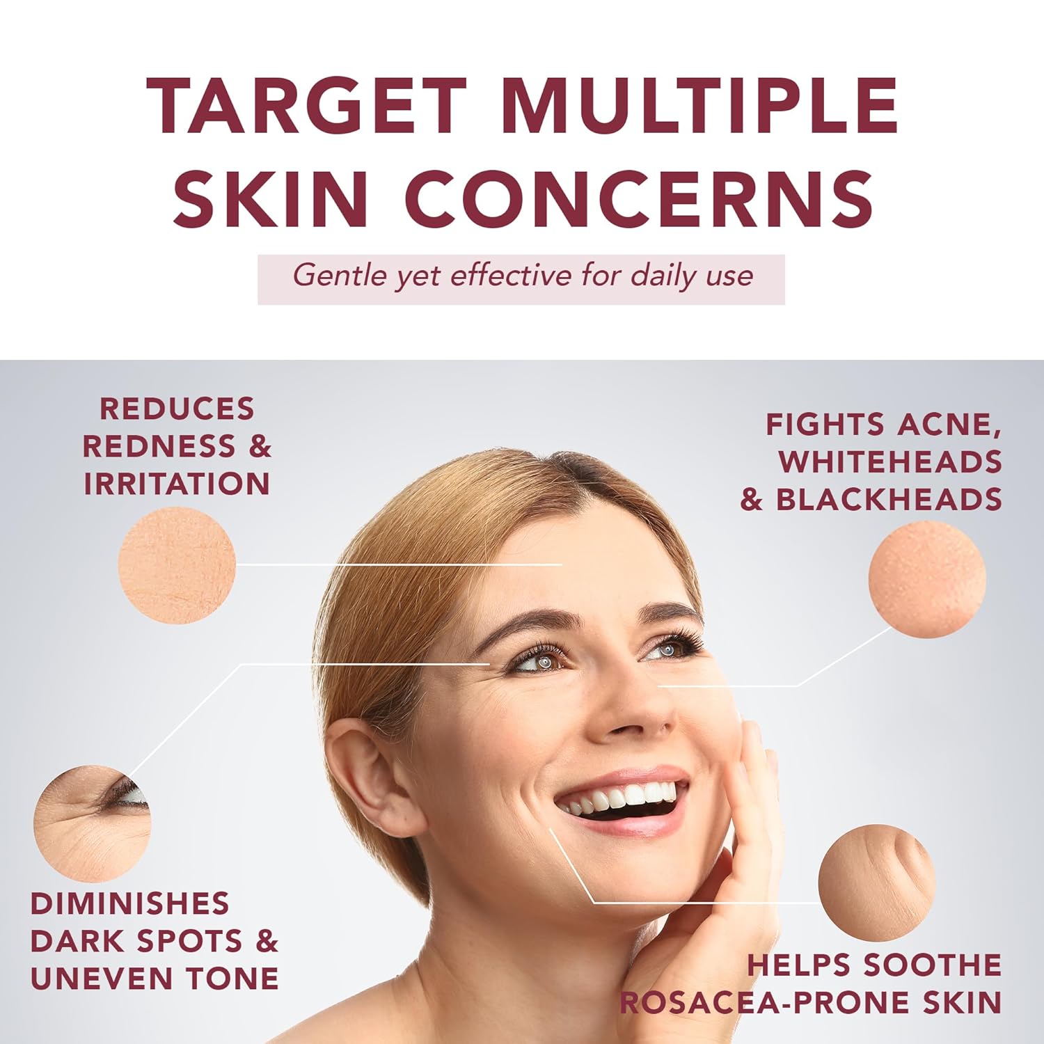 10% Azelaic Acid Serum with Niacinamide & Hyaluronic Acid – Rosacea Treatment For Face – Redness Relief, Blemish Relief, Brightening Skincare for Rosacea-Prone, Oily or Sensitive Skin, 30ml - Image 4